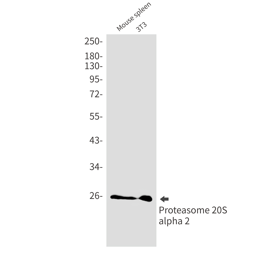 2 - PSMA2 Rabbit mAb AP75957