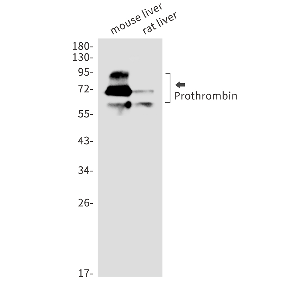 1 - Prothrombin Rabbit mAb AP75961