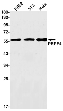 1 - PRPF4 Rabbit mAb AP75963