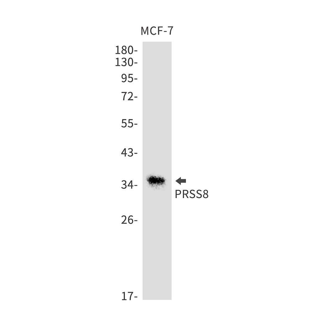 1 - PRSS8 Rabbit mAb AP75965