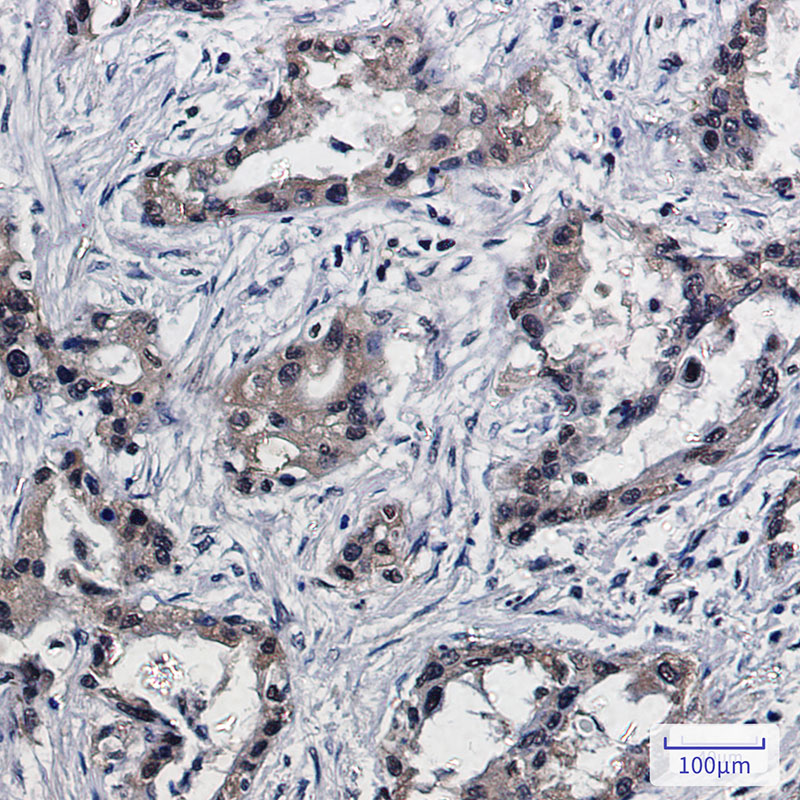 0 - [KO]PSMB10/MECL1 Rabbit mAb AP75970