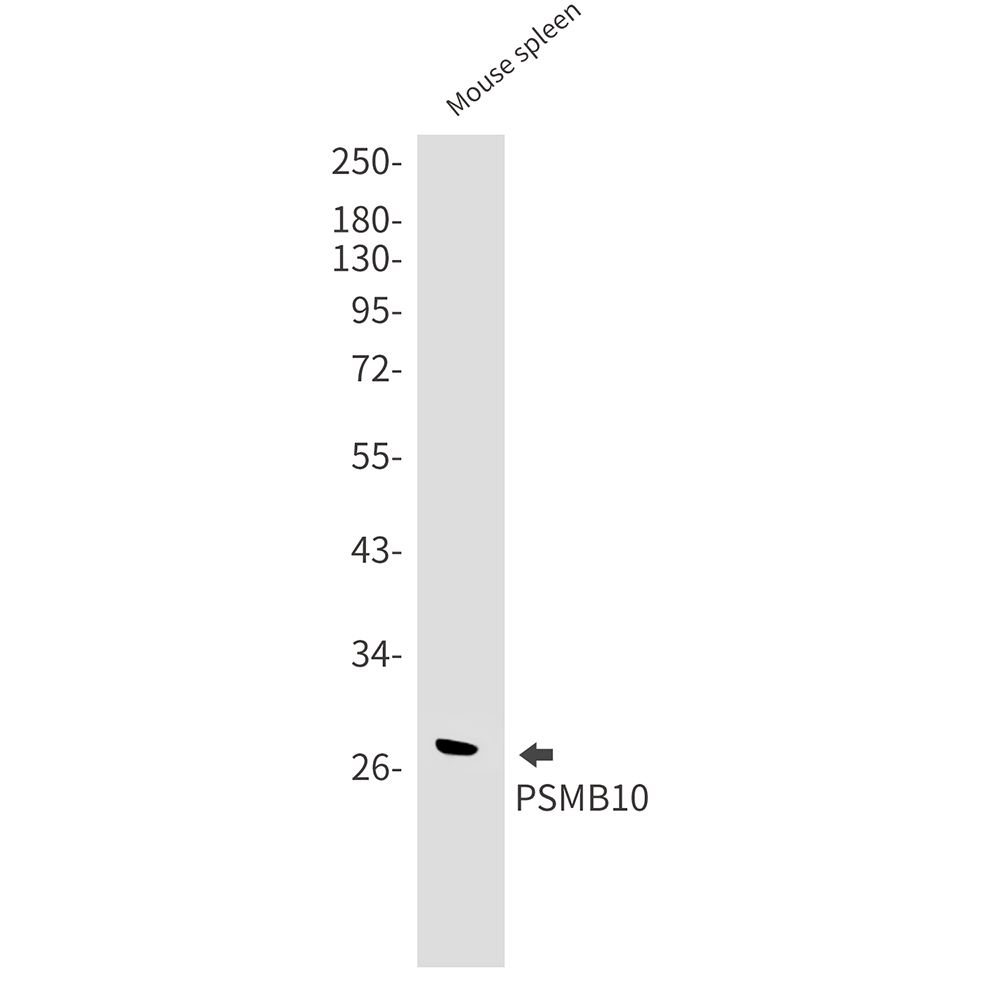 2 - [KO]PSMB10/MECL1 Rabbit mAb AP75970
