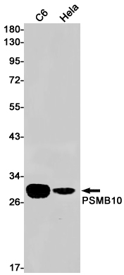 4 - [KO]PSMB10/MECL1 Rabbit mAb AP75970