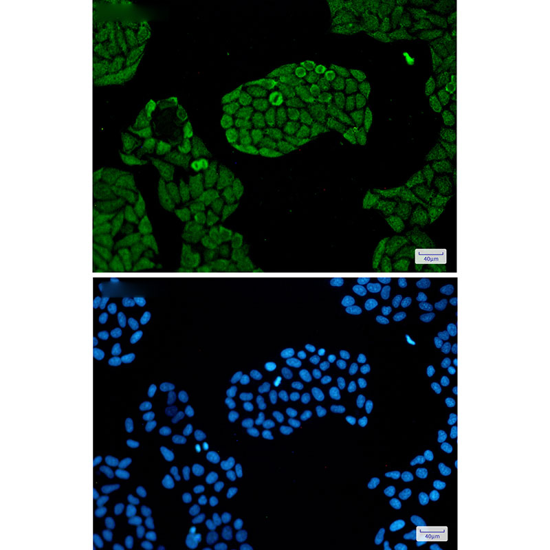 8 - PSMC5 Rabbit mAb AP75971