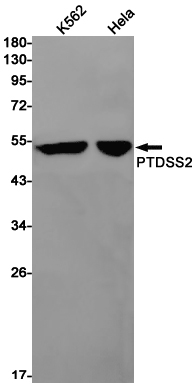 1 - PSS2 Rabbit mAb AP75972