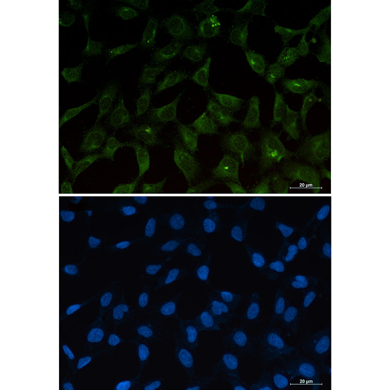 1 - PUMA Rabbit mAb AP75977