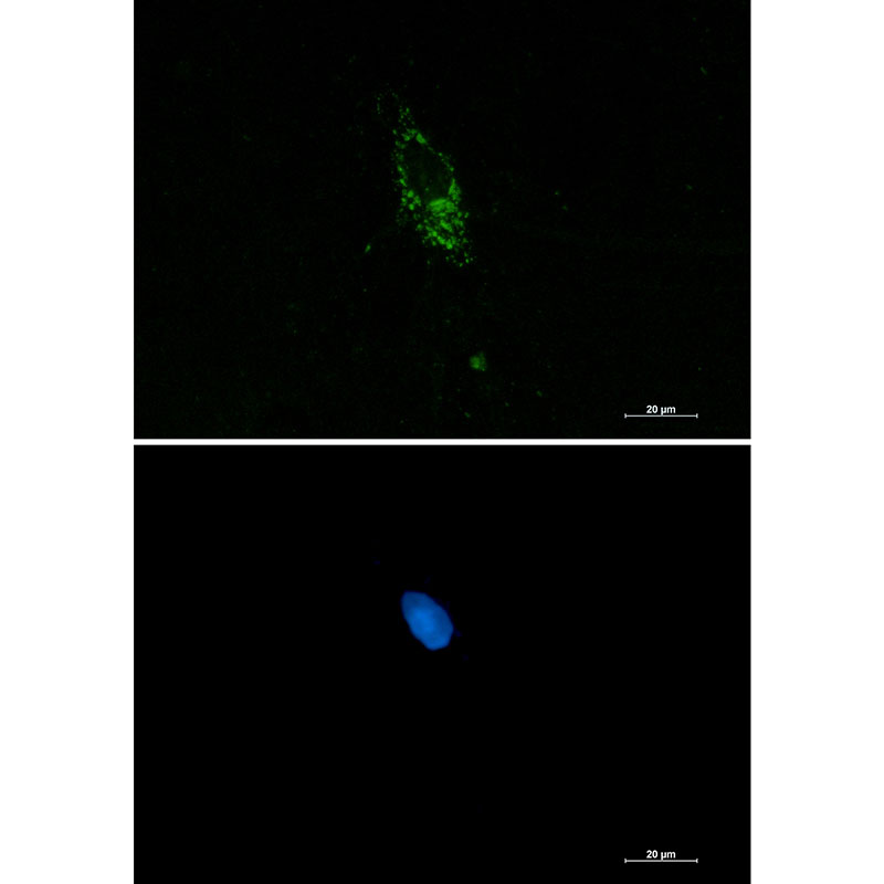 1 - Pumilio 1 Rabbit mAb AP75978