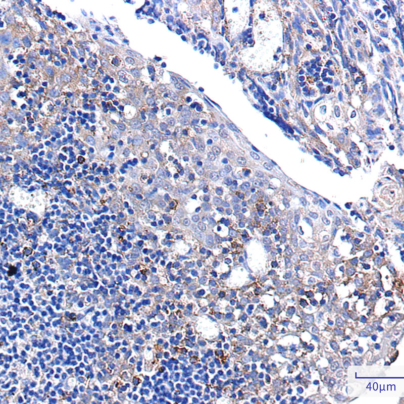 8 - Pumilio 1 Rabbit mAb AP75978