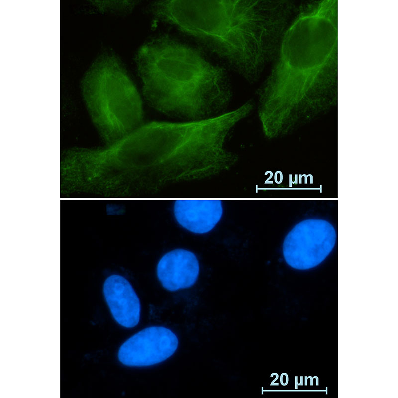 1 - RAB10 Rabbit mAb AP75983