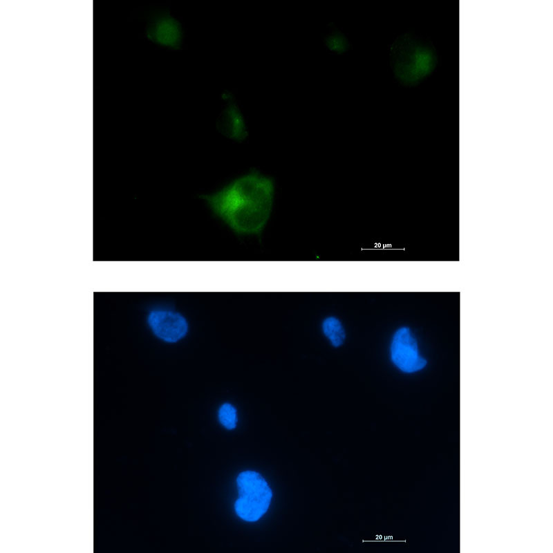 2 - [KD]Rab5 Rabbit mAb AP75986