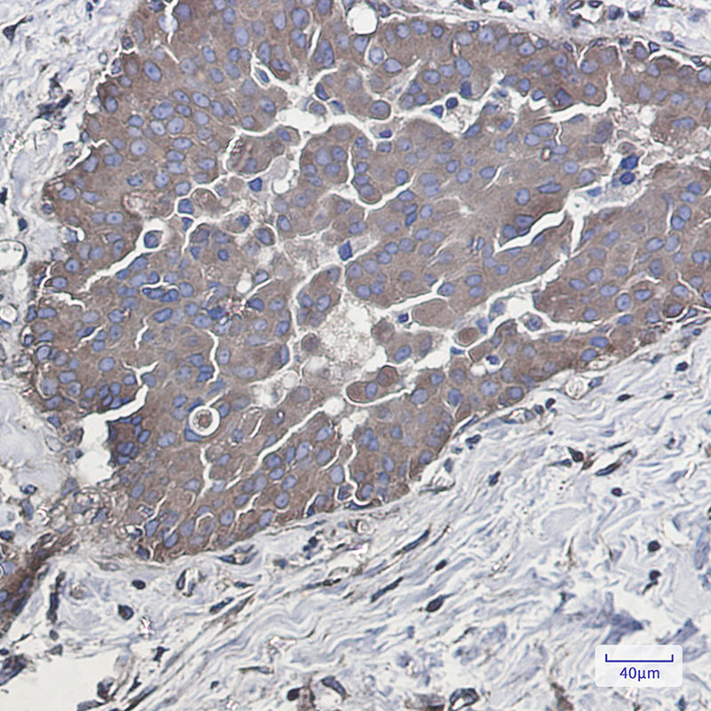 4 - [KD]Rab5 Rabbit mAb AP75986