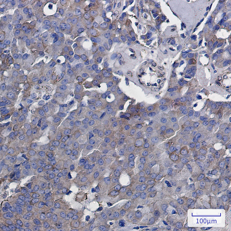 0 - [KO]Rab5 Rabbit mAb AP75987