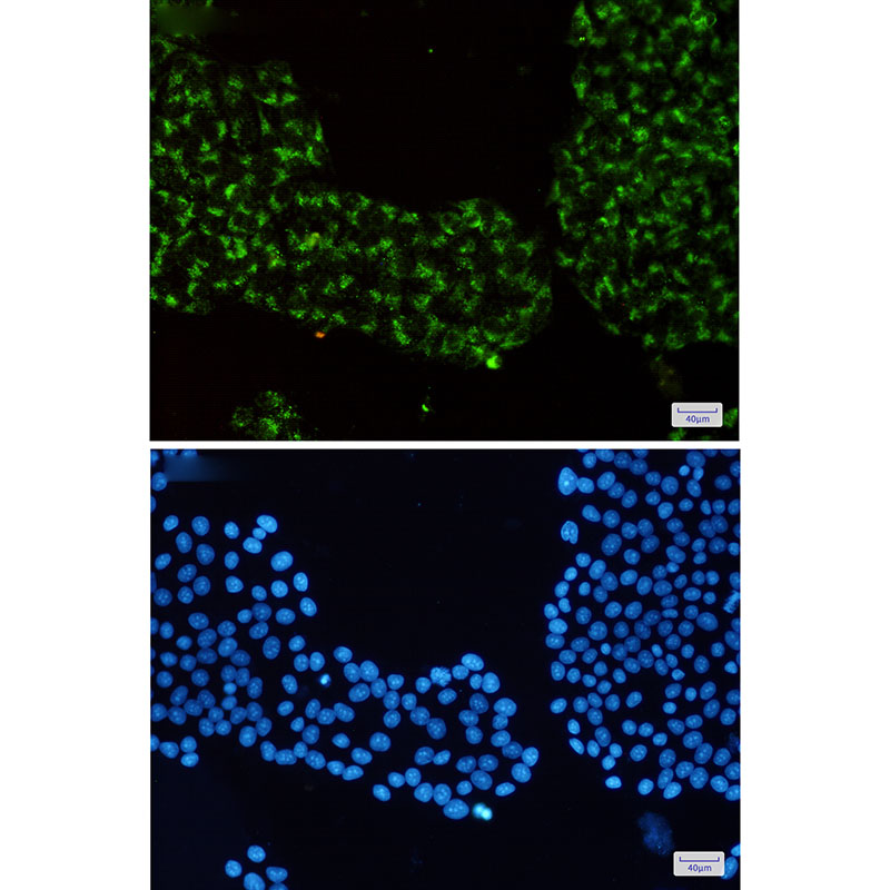 8 - Rab7 Rabbit mAb AP75988