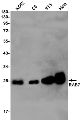 2 - Rab7 Rabbit mAb AP75988