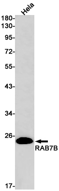 1 - Rab7B Rabbit mAb AP75990