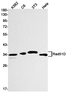 1 - Rad51D Rabbit mAb AP75994