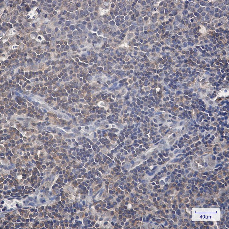 2 - Phospho-Raf1 (Ser259) Rabbit mAb AP75996