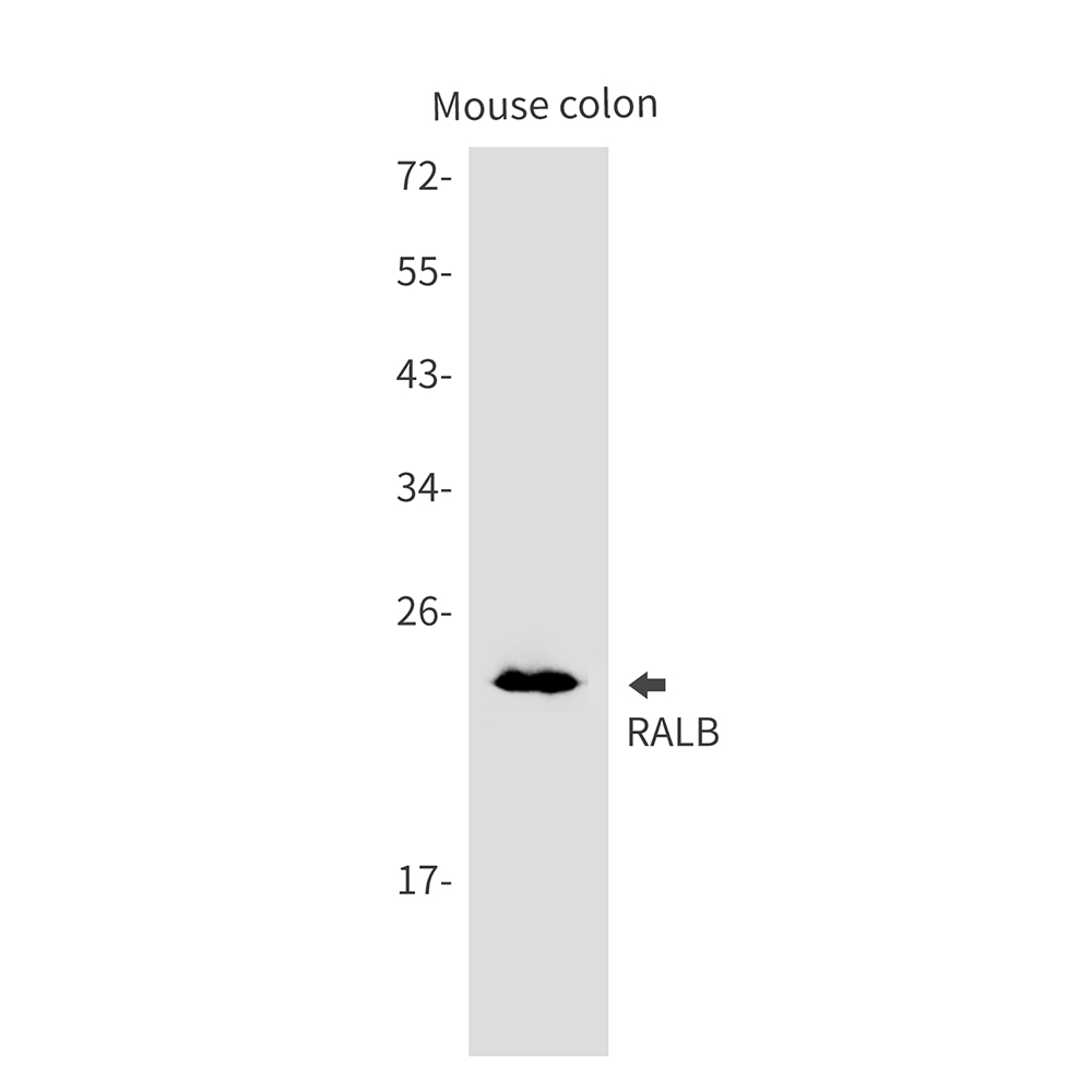 1 - RALB Rabbit mAb AP75999