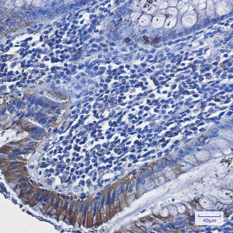 8 - RAVER2 Rabbit mAb AP76008
