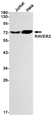 2 - RAVER2 Rabbit mAb AP76008