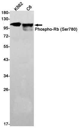 1 - Phospho-Rb (Ser780) Rabbit mAb AP76009