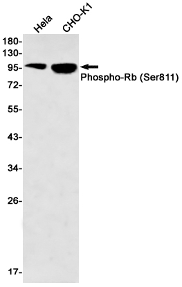 1 - Phospho-Rb (Ser811) Rabbit mAb AP76010
