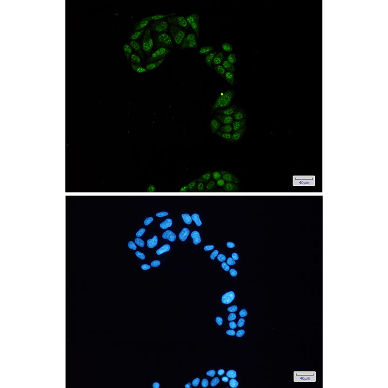 2 - Phospho-Rb2 p130 (Ser952) Rabbit mAb AP76012