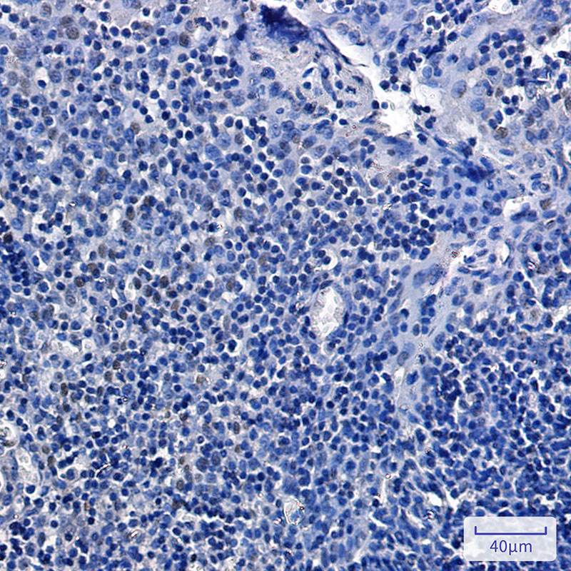 8 - Phospho-Rb2 p130 (Ser952) Rabbit mAb AP76012