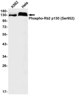 1 - Phospho-Rb2 p130 (Ser952) Rabbit mAb AP76012