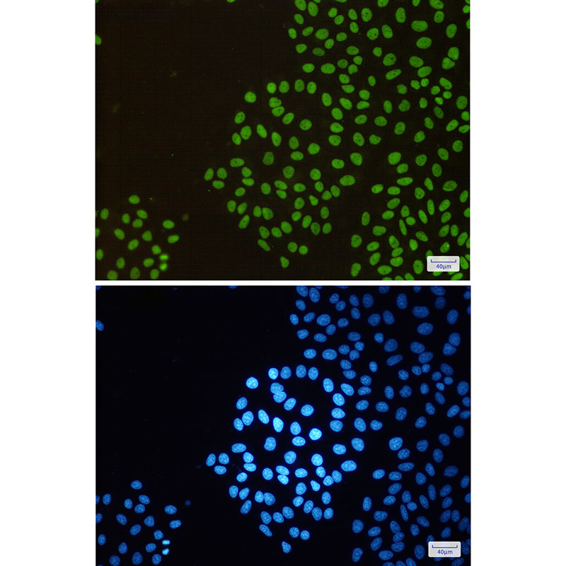 5 - RBBP4 Rabbit mAb AP76013