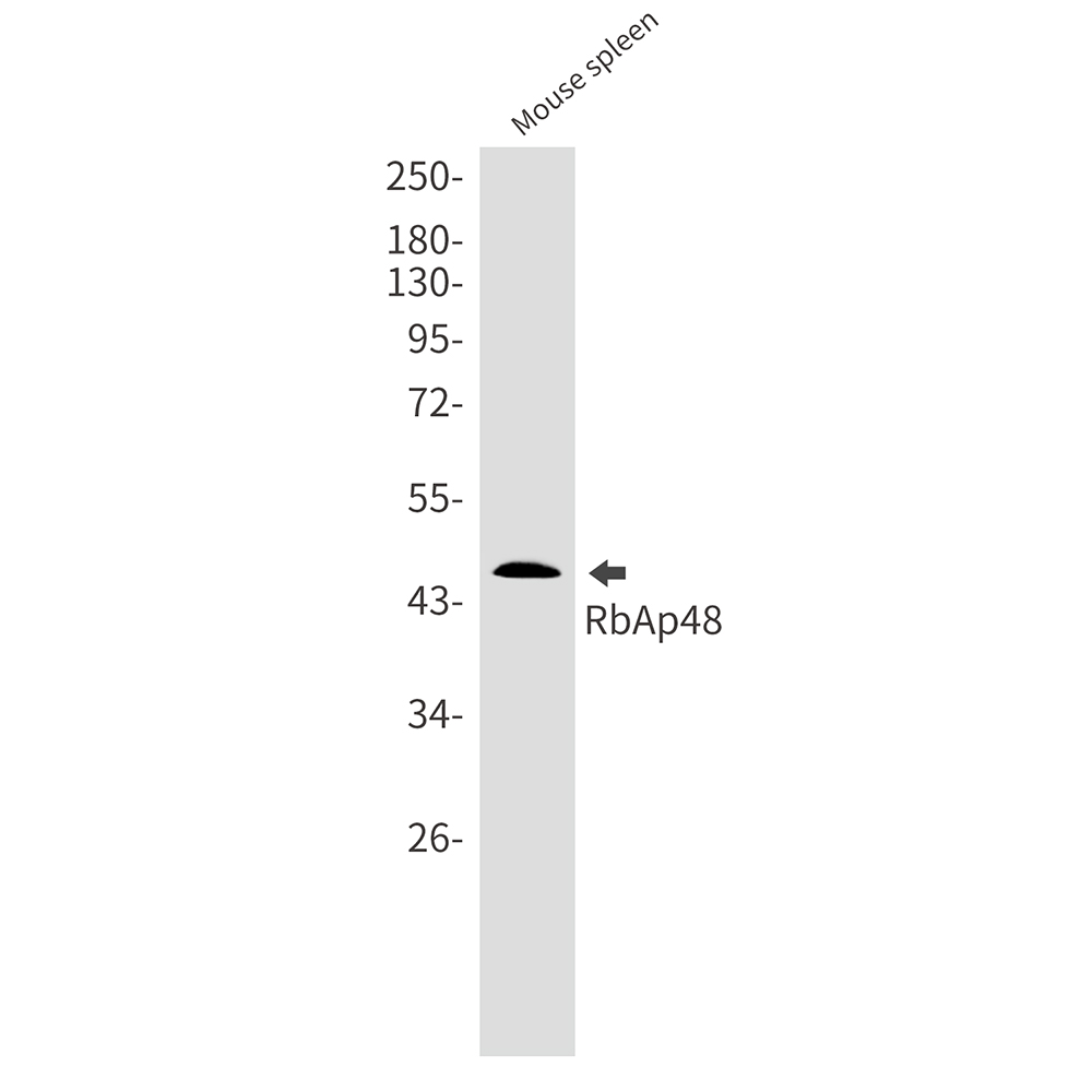 1 - RBBP4 Rabbit mAb AP76013