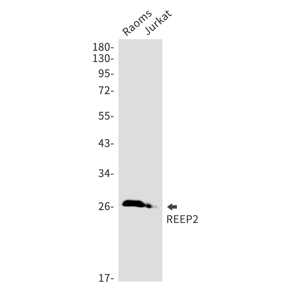 1 - REEP2 Rabbit mAb AP76016