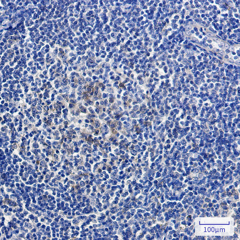 2 - Relaxin 2/RLN2 Rabbit mAb AP76018