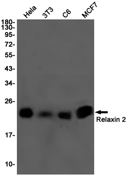 1 - Relaxin 2/RLN2 Rabbit mAb AP76018