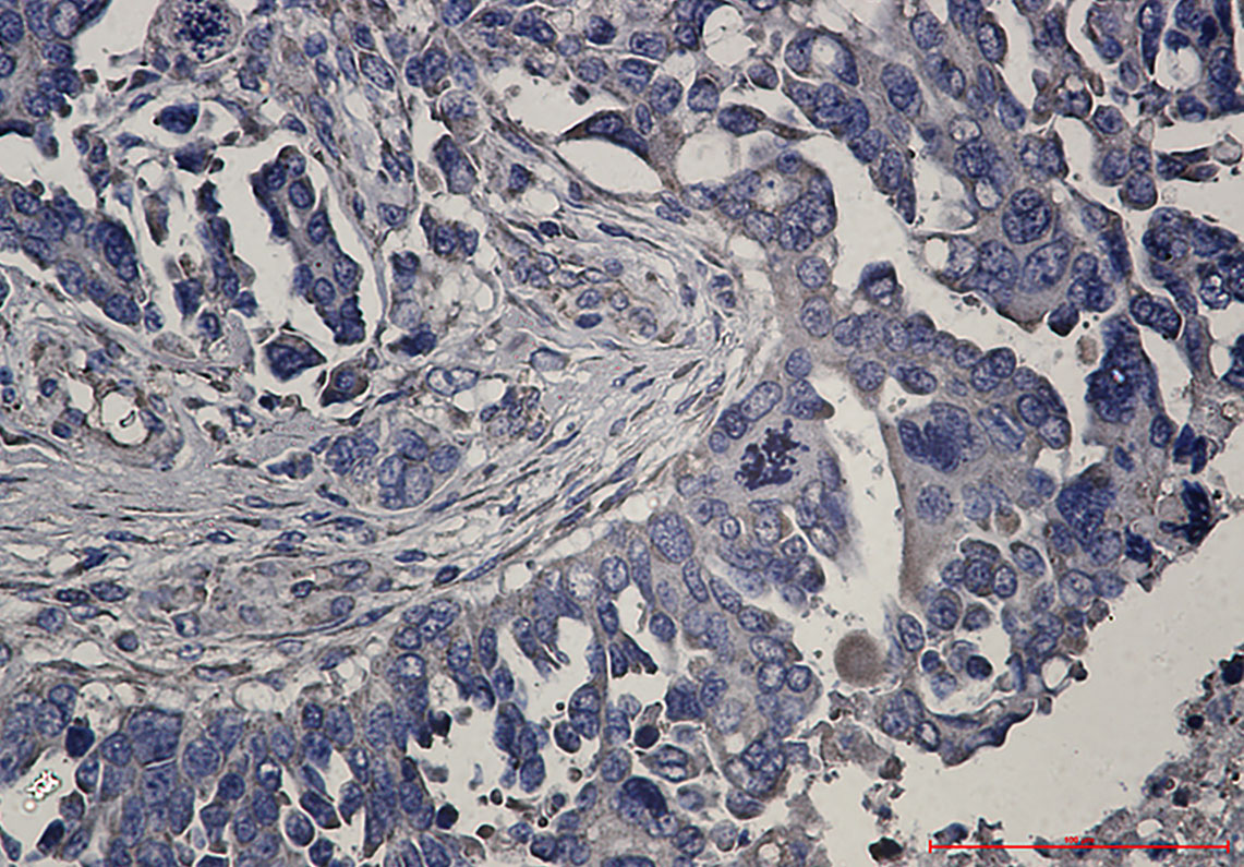 2 - RENT1 Rabbit mAb AP76019