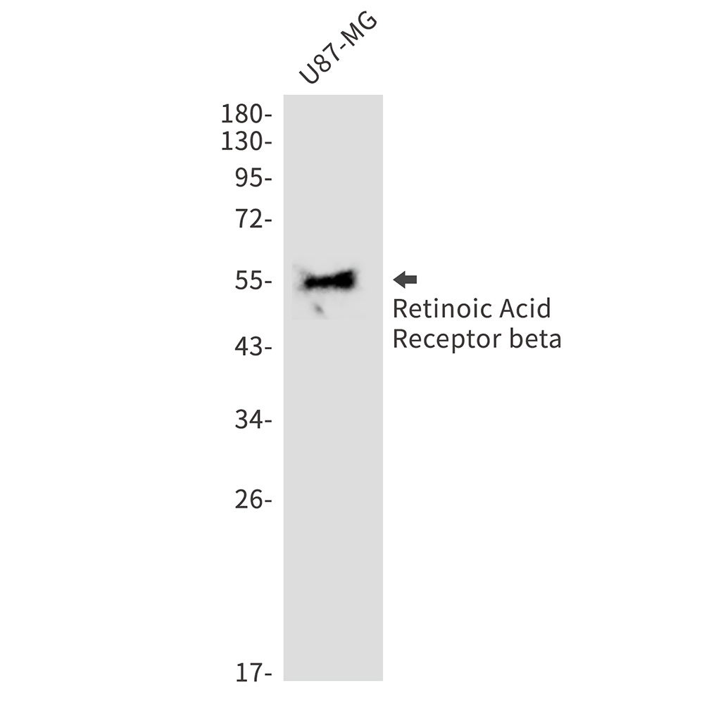 1 - Retinoic Acid Receptor beta Rabbit mAb AP76020