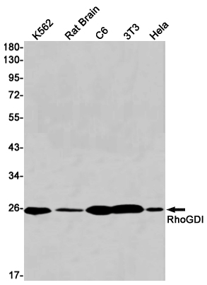 1 - [KO]RhoGDI Rabbit mAb AP76022