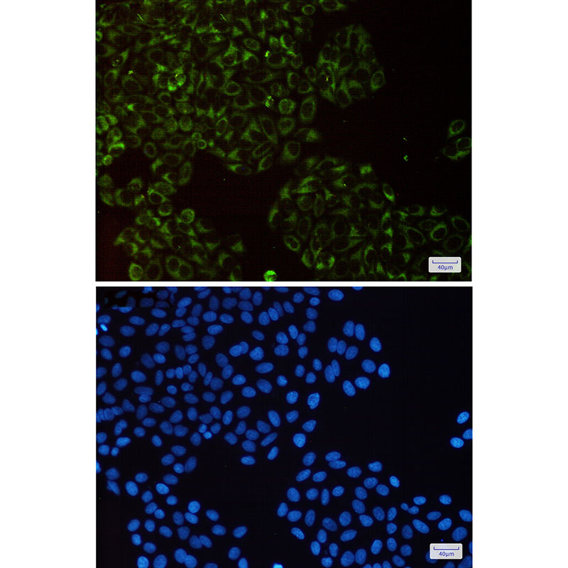2 - UQCRFS1 Rabbit mAb AP76024
