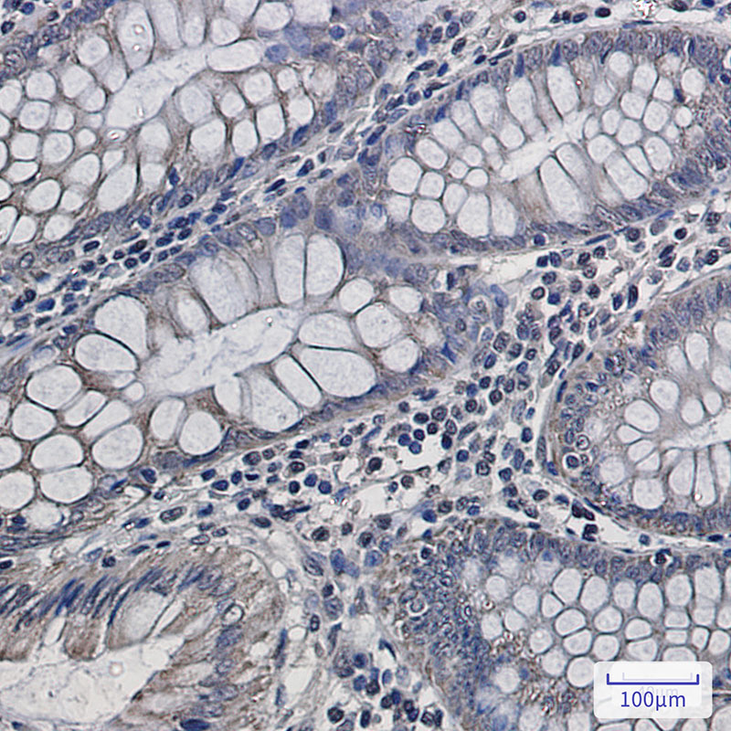 8 - UQCRFS1 Rabbit mAb AP76024