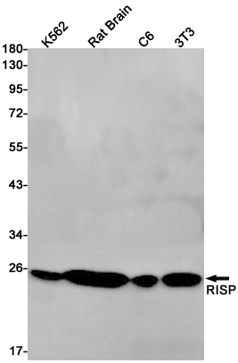 1 - UQCRFS1 Rabbit mAb AP76024