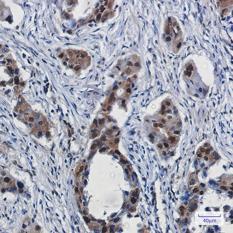 2 - RBX1 Rabbit mAb AP76028