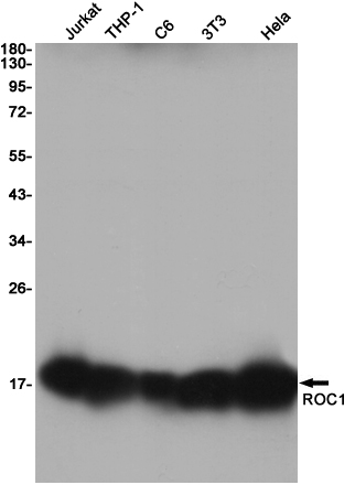 1 - RBX1 Rabbit mAb AP76028