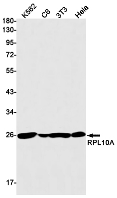 1 - RPL10A Rabbit mAb AP76034