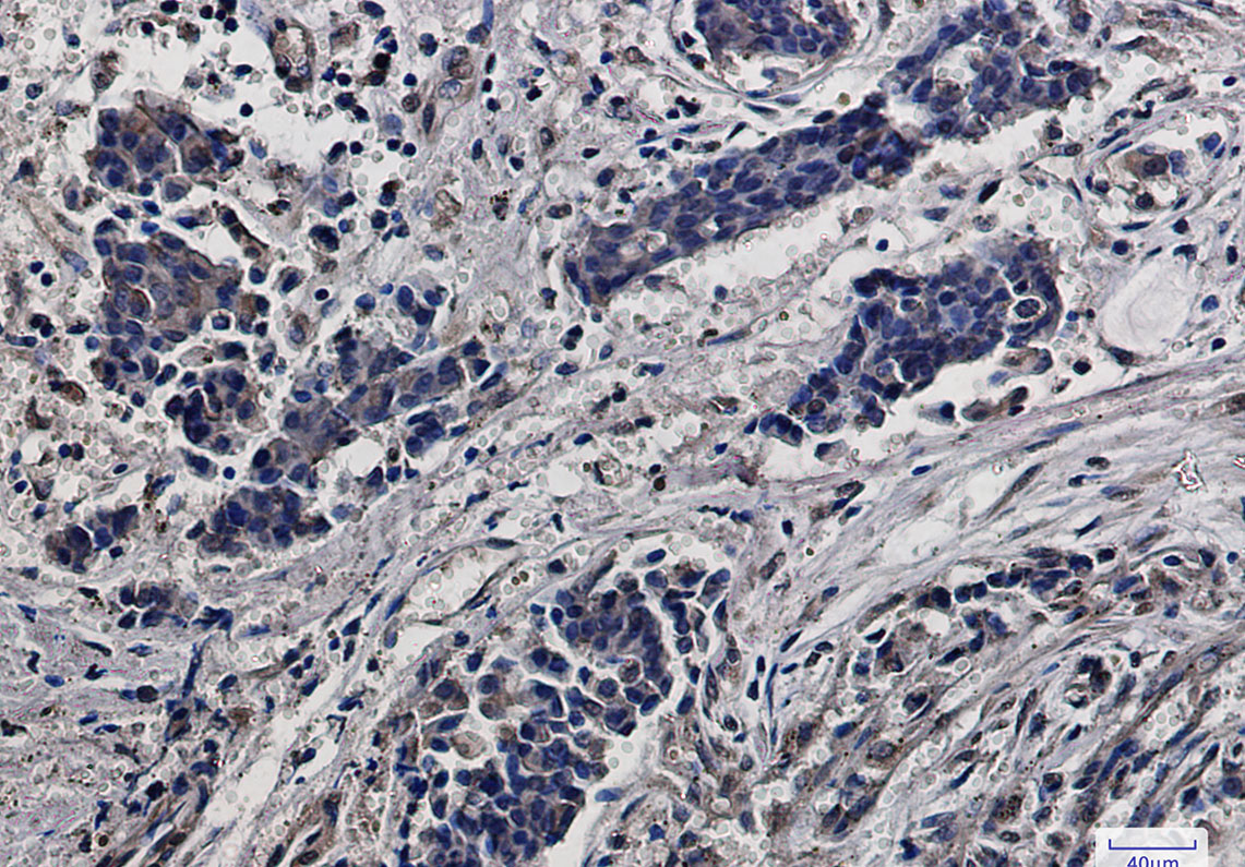 1 - RPS6 Rabbit mAb AP76035