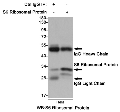 4 - RPS6 Rabbit mAb AP76035