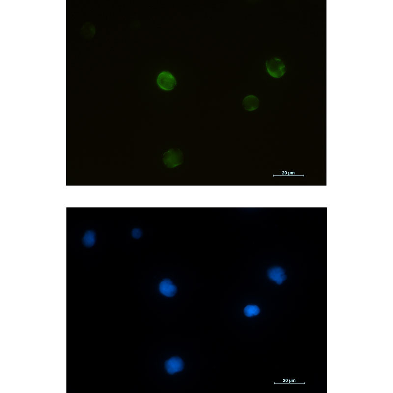 1 - RRM2 Rabbit mAb AP76038