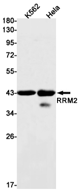 2 - RRM2 Rabbit mAb AP76038