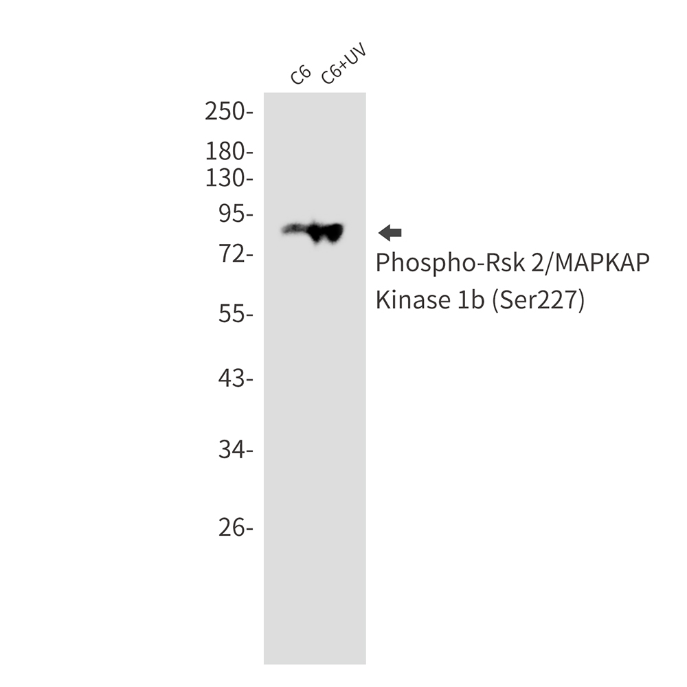 1 - Phospho-RSK2 (Ser227) Rabbit mAb AP76041