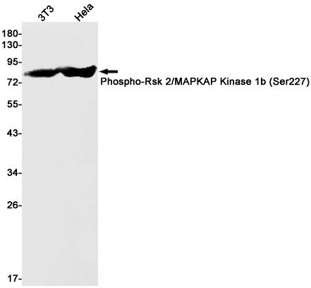 0 - Phospho-RSK2 (Ser227) Rabbit mAb AP76041