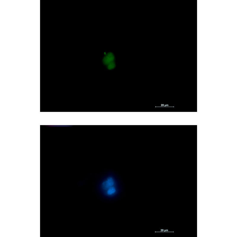1 - RUNX1/2/3 Rabbit mAb AP76043